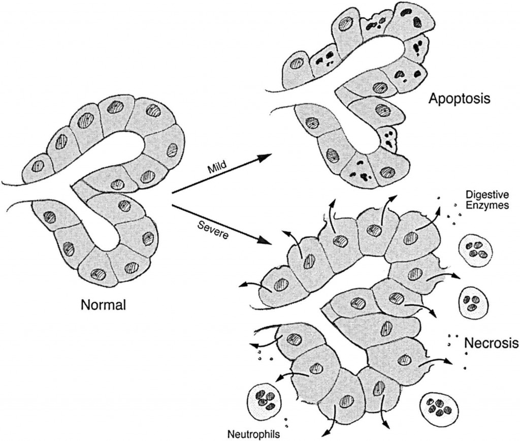 Diagrama-apoptosis